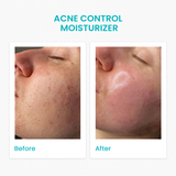 Daily Moisturizing Lotion