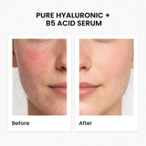 Pure Hyaluronic + B5 Acid Serum 30Ml