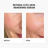 Retinol 0.5% Skin Renewing Serum 30Ml