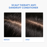 SCALP THERAPY ANTI-DANDRUFF CONDITIONER (240ML)