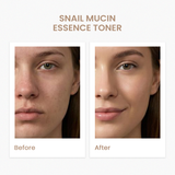 Snail Mucin Essence Toner (120ML)