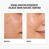 Snail Mucin Essence Glass Skin Magic Serum 30Ml