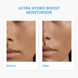 Ultra Hydro Boost  Moisturizer 24-hrs hydration