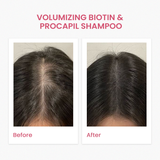 VOLUMIZING BIOTIN & PROCAPIL SHAMPOO (240ML)